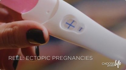 Ectopic Pregnancies